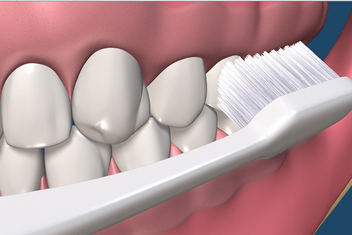 BRUSHING FLOSSING MOUTHWASH | SmileOra Dental Care